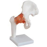 Ball Joint Components