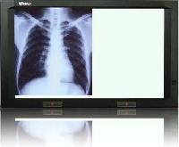 X-ray Film Viewers