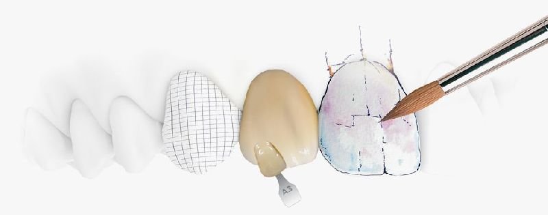 Digital Crown & Bridges 01