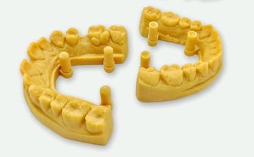 Digital Crown & Bridges 03