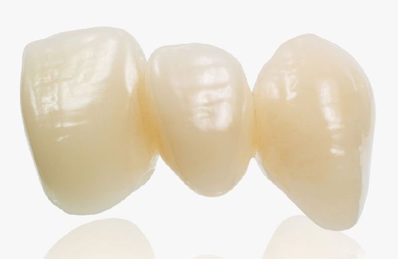 Zirconia Crowns and Bridges 02