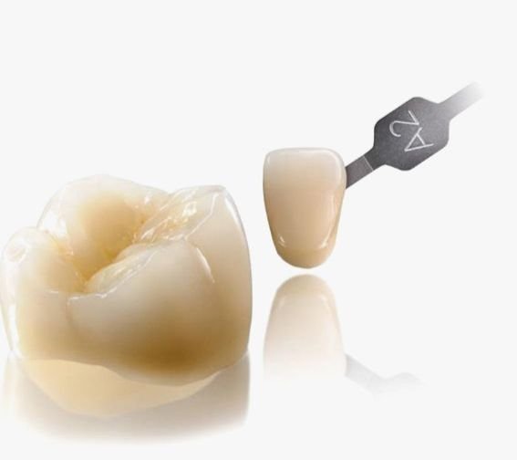 Zirconia Crowns and Bridges 03