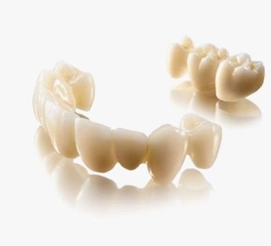 Zirconia Crowns and Bridges 04