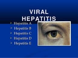 F Hepatitis