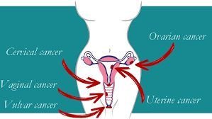 FEMALE CANCER - D