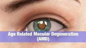 Macular Degeneration D