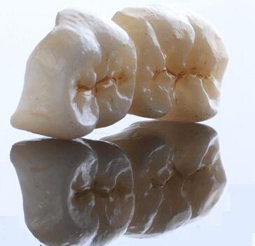 Zirconia Crowns and Bridges 01