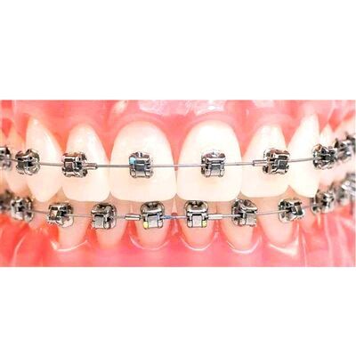 Orthomatix Passive Self Ligating Metal Bracket