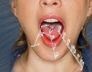 Stammering Treatment Service 03