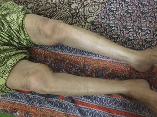 Arthritis Treatment 01