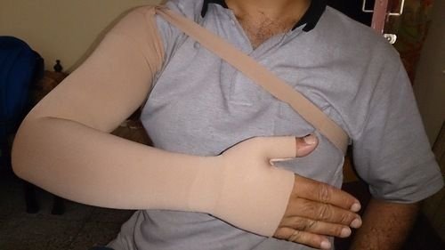 Lymphedema Arm Sleeve 01