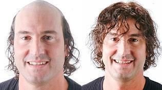 Mens Hair Weaving Services 02