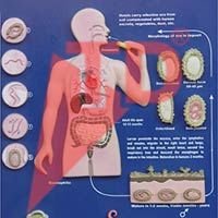 Ascaris Lumbricoides Model