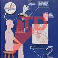 Wuchereria Bancrofi Model