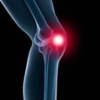 Knee Pain