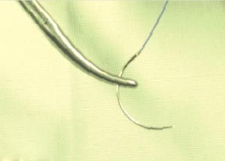 Polyglactin Suture 02