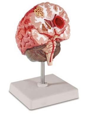 Brain Model