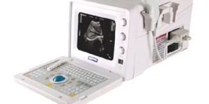 Ultrasound Machine