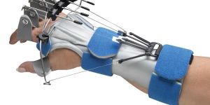 Hand Splints