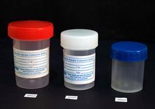 Urine Container with Screw Type Cap