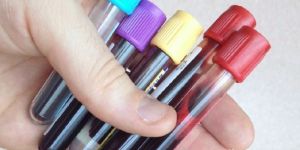 Blood Collection Tube