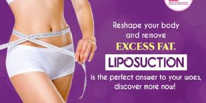 Liposuction Surgery
