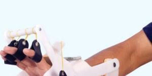DYNAMIC RADIAL PALSY SPLINT