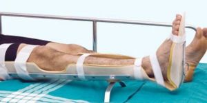 Full Leg Splint