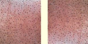 Kit Topline Ceiling Tiles