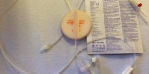 LEUCOCYTE FILTER