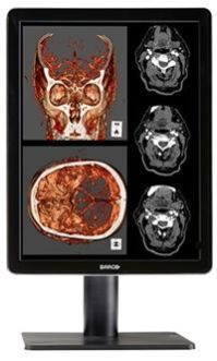 Barco Diagnostic Display