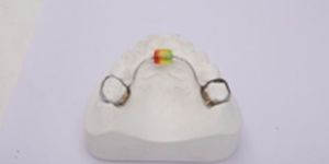 Removable Tongue Trainer with Bead