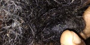 Hair