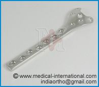 Condylar Buttress Plate