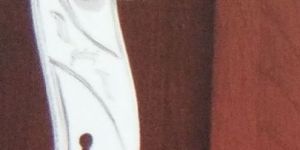 Plate 777 Stainless Steel Safe Cabinet Lock Handle