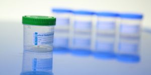 30ml Urine Sample Container