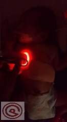 Pediatric Infant Super Torch Vein Finder Device