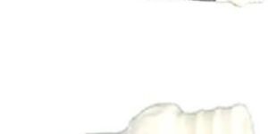 High Flow Oxygen Therapy Cannula