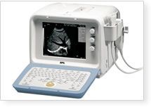Digital Ultrasound Scanner