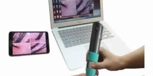 Hair Scalp Follicle Analyser