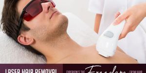 Laser Hair Removal Services