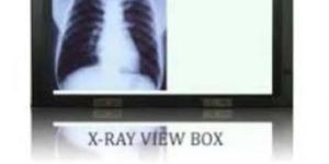 X Ray View Box