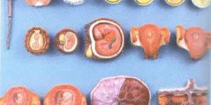 HUMAN FERTILIZATION Model