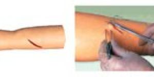 Surgical Suture Arm Model