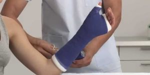 Articast Fiberglass Casting Tape