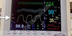 End Tidal Carbon Dioxide Monitor