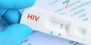HIV Test Kit
