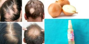 Hair Regrowth Treatment Non Invasive Therapy