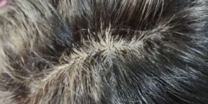 GENTS HAIR PATCH