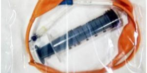 Esophageal Sengstaken Tube